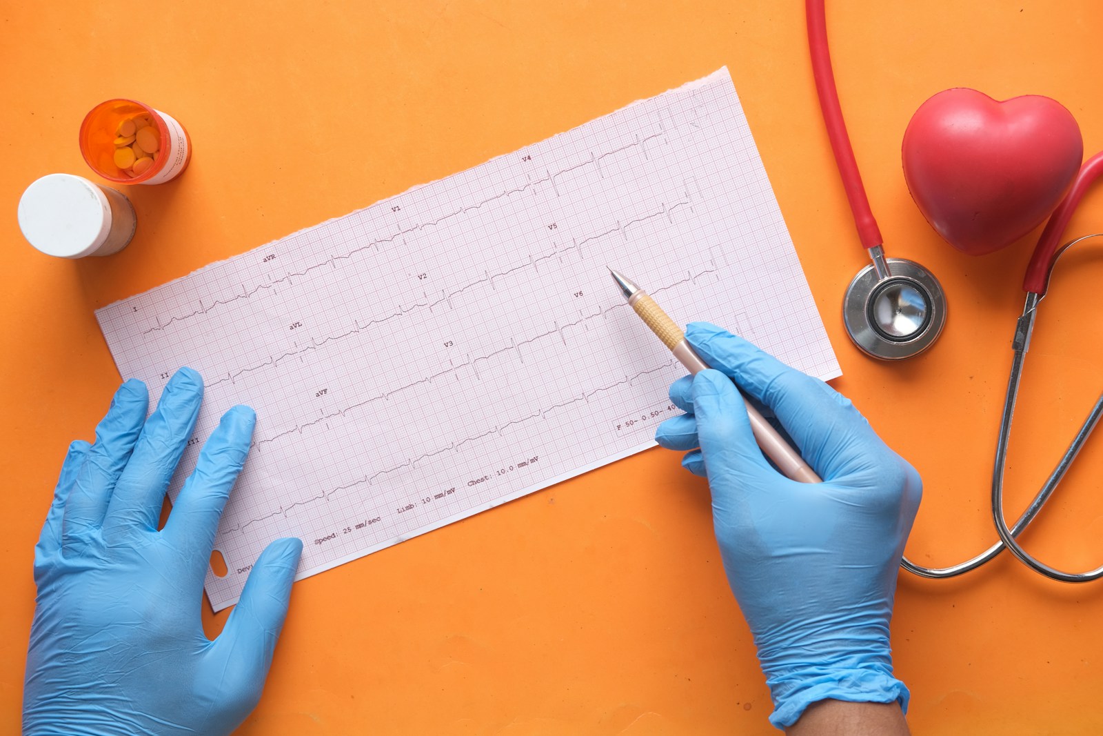 Choroby układu krążenia – jak wygląda diagnostyka i leczenie kardiologiczne w Jaworznie?